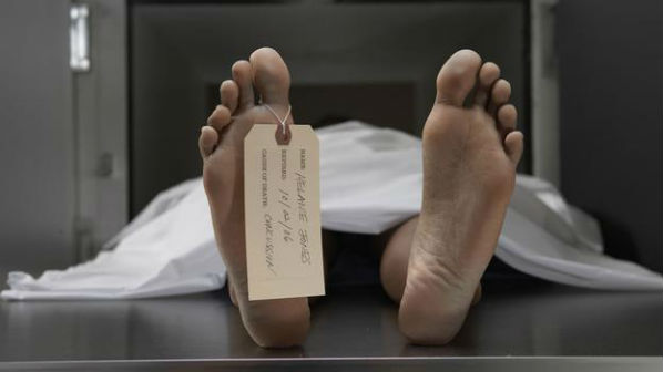 Quando os cadáveres chegam à necropsia, chegam com as roupas com as quais morrem e é trabalho do especialista despí-lo para iniciar a necropsia.